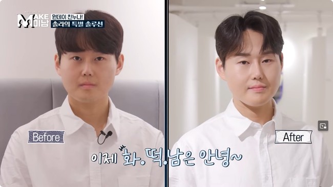 Setelah menjalani berbagai prosedur menyakitkan, ia akhirnya bisa tersenyum sumringah dengan penampilan baru. Agar transformasinya semakin total, dalam program, supir bus tersebut juga dibawa ke salon untuk dirias oleh makeup artist. Hasilnya, ia lebih tampan seperti aktor drama atau idol Korea. Foto: Dok. YouTube Hellotv