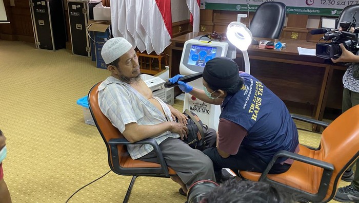 Hamim peserta hapus tato gratis (Devi/detikcom)