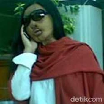 lisa face off operasi 17 kali di rsu dr soetomo
