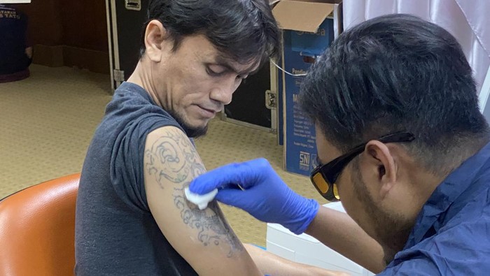 Peserta hapus tato, Abdel.