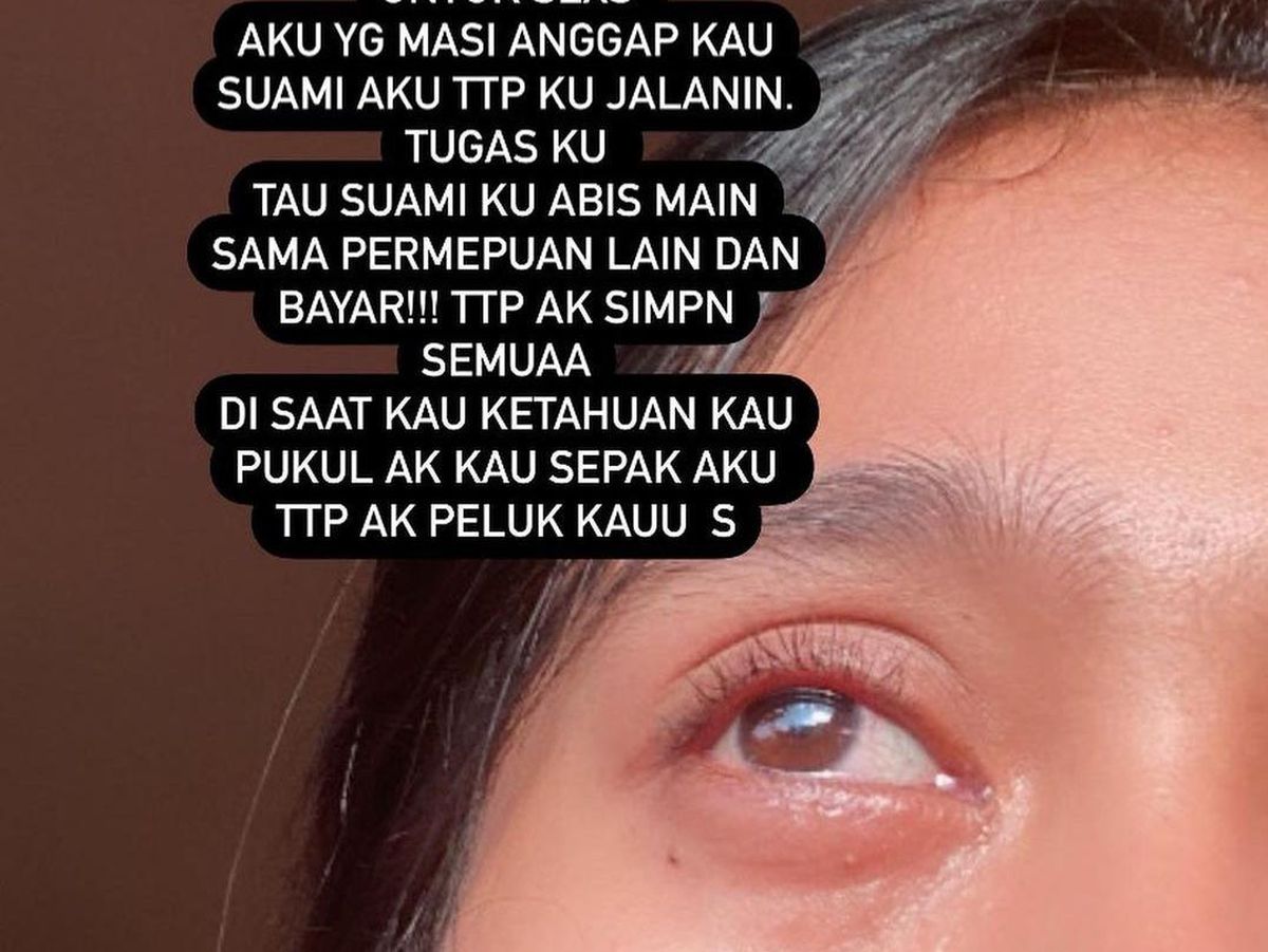 Viral Wanita Ngaku Istri Polisi Sebut Dianiaya hingga Diselingkuhi Suami