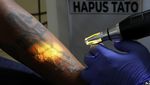 Warga Ramai-ramai Hapus Tato Gratis di Kantor Walikota Jakpus