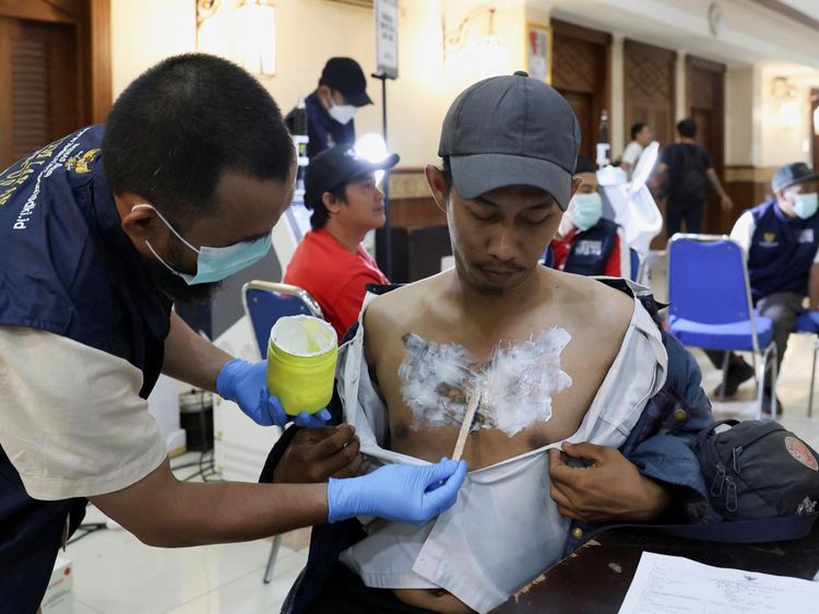 Warga Ramai-ramai Hapus Tato Gratis di Kantor Walikota Jakpus