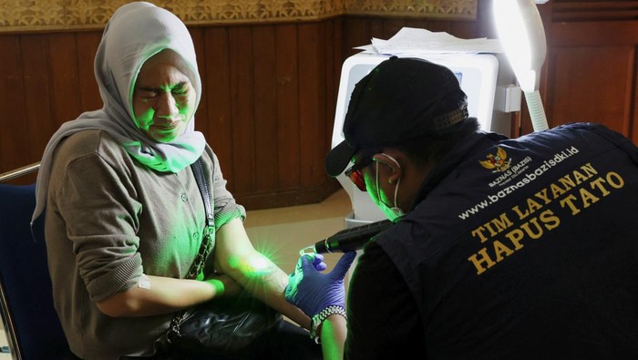 Warga Ramai-ramai Hapus Tato Gratis di Kantor Walikota Jakpus Indy, 39, reacts as she gets her tattoo removed with a laser during the event held by BAZNAS which provides a free tattoo removal program during the holy month of Ramadan at the Central Jakarta Mayor Office in Jakarta, Indonesia, March 26, 2024. REUTERS/Ajeng Dinar Ulfiana