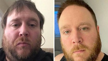 Setahun berhenti minum alkohol, wajahnya beda banget. Foto: Rim1230 via Bored Panda