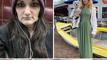 Waktu kecanduan, wajahku kolaps karena aku kehilangan banyak gigi diakibatkan obat-obatan, itu sangat menyedihkan. Sudah hampir dua tahun aku bersih dan sekarang aku punya wajah penuh serta seekor anak anjing, kisah perempuan ini. Ditambah lagi, dia sudah punya pasangan yang sama-sama sudah sembuh dari kecanduan. Foto: Kaitlinmds via Bored Panda