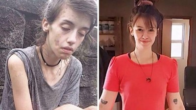 Potret Transformasi Orang-orang yang Berhasil Lepas dari Kecanduan