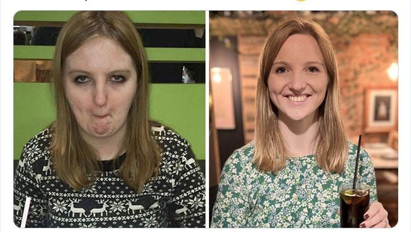 Lepas dari kecanduan bukan hal yang mudah. Tepuk tangan dan beri semangat buat teman-teman yang berhasil berhenti kecanduan!