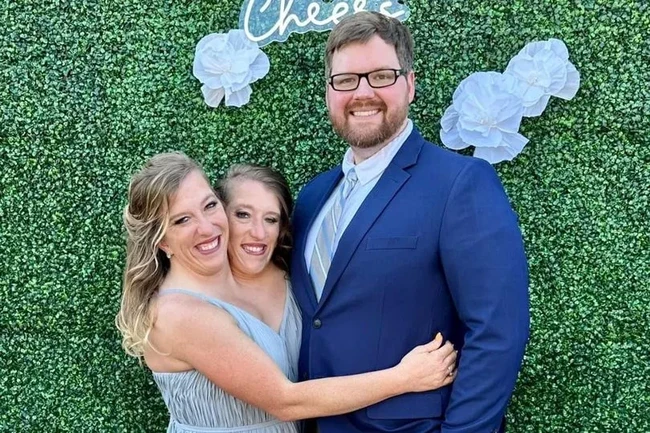 Abby dan Brittany Hensel menjadi terkenal pada usia enam tahun ketika mereka muncul dalam sebuah episode acara Oprah Winfrey pada 1996. Foto: Dok. Facebook