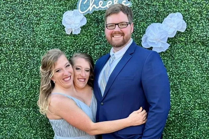 Abby dan Brittany Hensel