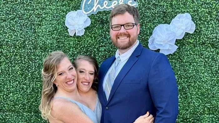 Abby dan Brittany Hensel