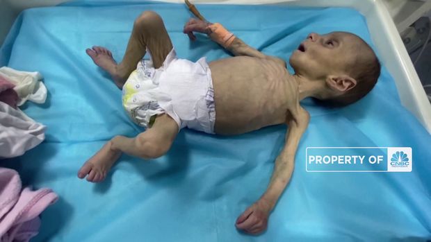 Bayi Palestina Melawan Kelaparan