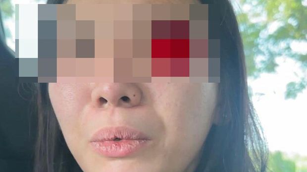 Pengasuh yang diduga menganiaya anak selebgram di Malang.