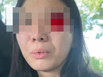 Pengasuh yang Aniaya Anak Selebgram Malang Aghnia Punjabi Diamankan Polisi