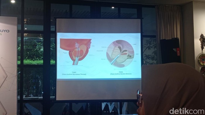 Raja Charles III Saja Bisa Kena, Kapan Sih Pria Harus Periksa Prostat?