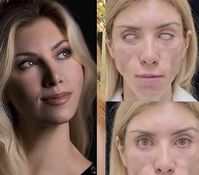 “Saya datang kepada mereka dengan wajah yang sehat dan indah, namun operasi yang dilakukan justru meninggalkan kerusakan tak terperbaiki,” ungkap Julia, seperti dikutip dari The Sun. Foto: Dok. Instagram