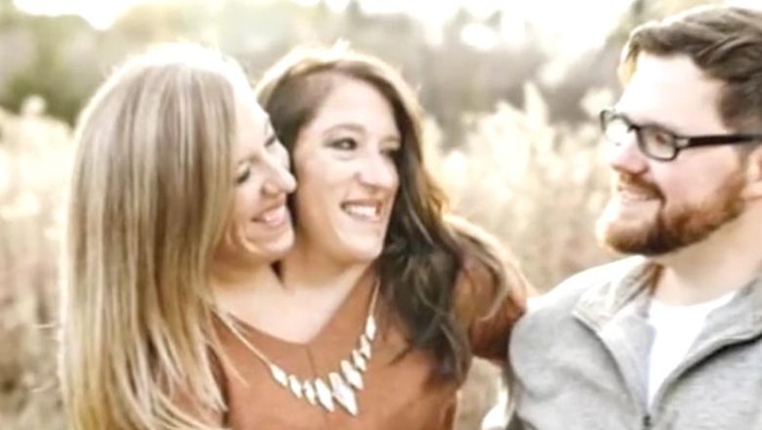 Viral Wanita Kembar Siam Abby Hensel Sudah Menikah, Ini Rencananya soal Anak