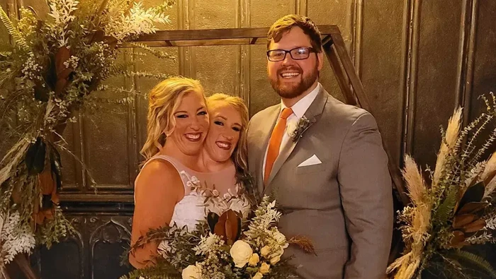 Abby dan Brittany Hensel