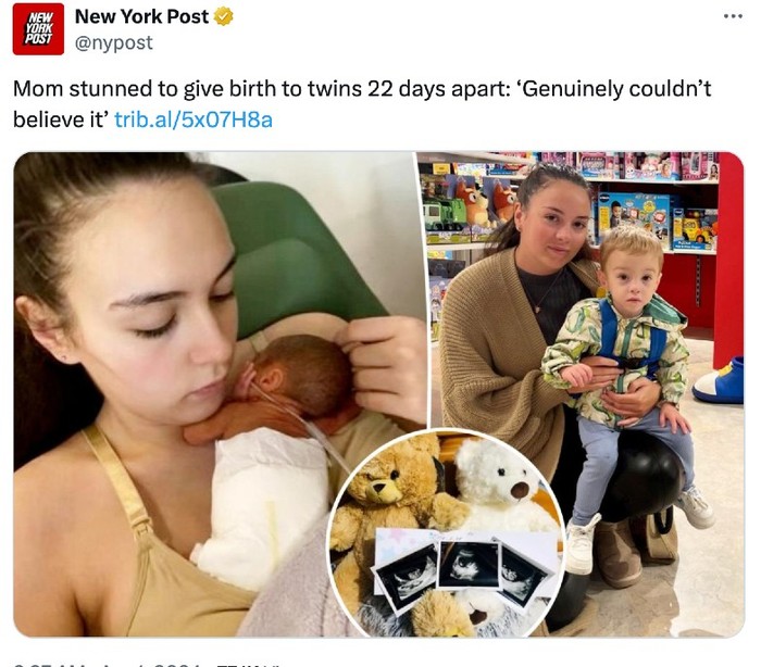 Ibu melahirkan kembar beda 22 hari