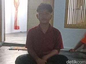 Pengakuan Riski yang Mata Kirinya Kena Semburan Bisa Kobra