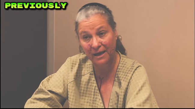 Evie memenangkan mommy makeover dari Braun Plastic Surgery. Ia pun diterbangkan ke Korea untuk menjalani operasi bukan hanya pada wajah tapi juga payudara.  Foto: YouTube BRAUN Plastic Surgery Korea