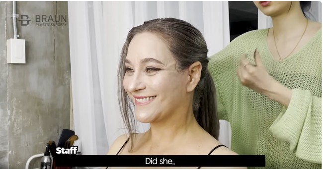 Begini penampilan barunya yang sudah dioperasi.  Foto: YouTube BRAUN Plastic Surgery Korea
