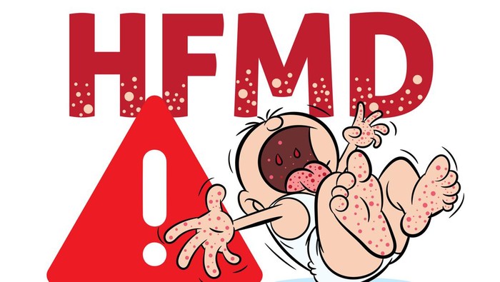 Anak Kena Flu Singapura, Butuh Berapa Lama Buat Sembuh?