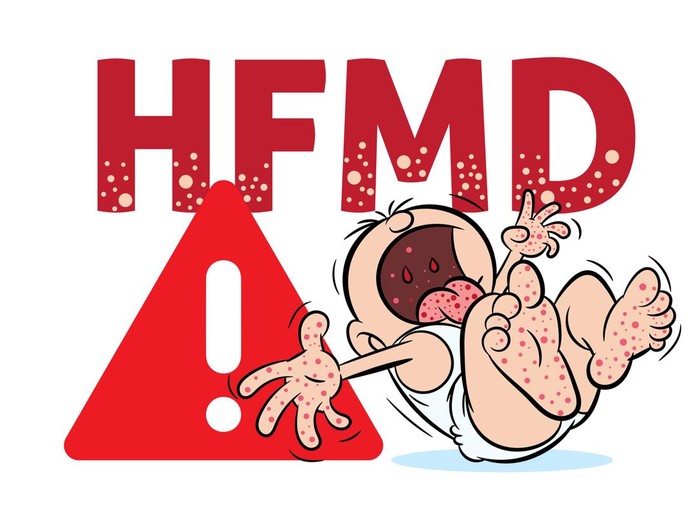 Banyak Dialami Anak Usia 5 Tahun, Ini Gejala Flu Singapura yang Harus Diwaspadai