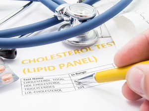 Viral di Medsos Usia Baru 21 Sudah Punya Kolesterol Tinggi, Inikah Pemicunya?