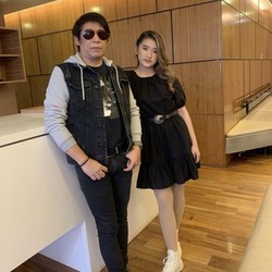 Parto Dukung Amanda Caesa Jadi Penyanyi, Selalu Datang Tiap Manggung