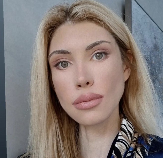 Yulia melakukan facelift dan operasi pada kelopak mata. Namun bukannya jadi lebih cantik, Yulia justru mengalami deformasi wajah yang mengerikan.  Foto: Dok. Instagram, YouTube