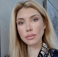 Yulia melakukan facelift dan operasi pada kelopak mata. Namun bukannya jadi lebih cantik, Yulia justru mengalami deformasi wajah yang mengerikan.  Foto: Dok. Instagram, YouTube