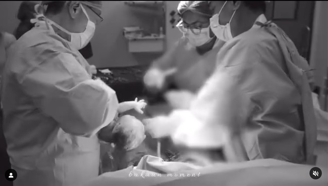 Setelah beberapa menit berlalu akhirnya keluarlah putri kecil mereka. Baby Kyarra lahir pada Rabu, 20 Maret 2024 dengan berat 3,1 kg dan panjang 51 cm. Foto: dok. Instagram/@jscmila