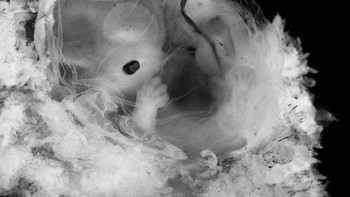 Embrio berusia 6 minggu, kurang dari 1,5 cm Foto: Lennart Nilsson via Boredpanda