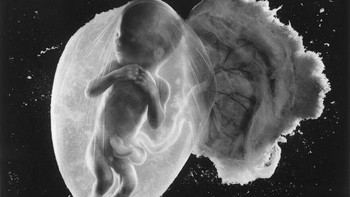 Janin 18 minggu Foto: Lennart Nilsson via Boredpanda