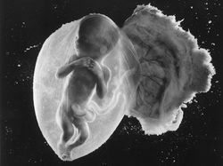 Foto Janin Dalam Kandungan Bikin Takjub Akan Kebesaran Allah