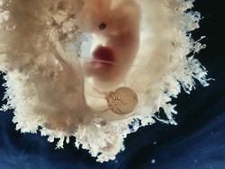 Foto Janin Dalam Kandungan Bikin Takjub Akan Kebesaran Allah