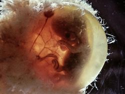 Foto Janin Dalam Kandungan Bikin Takjub Akan Kebesaran Allah