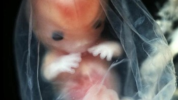 Janin berusia 8 minggu, kira-kira 4 cm Foto: Lennart Nilsson via Boredpanda