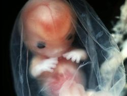 Foto Janin Dalam Kandungan Bikin Takjub Akan Kebesaran Allah