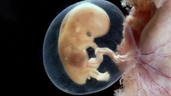 Embrio berusia 2 bulan 1 minggu, ukurannya 4 cm Foto: Lennart Nilsson via Boredpanda