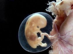 Foto Janin Dalam Kandungan Bikin Takjub Akan Kebesaran Allah