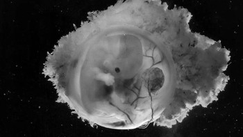 Embrio berusia 6 minggu, ukurannya 1,5 cm Foto: Lennart Nilsson via Boredpanda