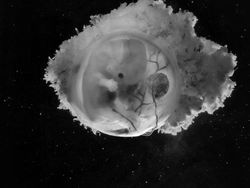 Foto Janin Dalam Kandungan Bikin Takjub Akan Kebesaran Allah