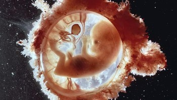 Ini gambar Janin berusia 13 minggu. Foto: Lennart Nilsson via Boredpanda
