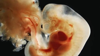 Ini gambar emrio berusia 5 minggu. Foto: Lennart Nilsson via Boredpanda