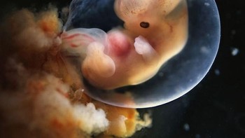 Ini gambar emrio berusia 7 minggu. Foto: Lennart Nilsson via Boredpanda