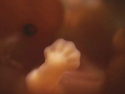 Foto Janin Dalam Kandungan Bikin Takjub Akan Kebesaran Allah