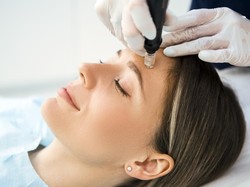 Video: Mengenal Derma Roller, Alat Treatment di Kasus Klinik Kecantikan Ria Beauty