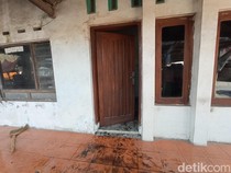 Pilu Istri Sekujur Tubuh Dibakar Suami Sendiri di Cirebon
